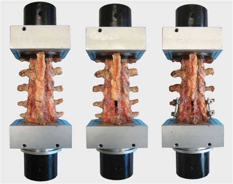 spine biomechanical testing methods